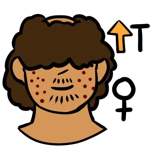 a person with brown skin tone. They have acne, facial hair, and a bald spot on the top of their head. They have medium brown curly hair. In the upper left of the image is an orange up arrow next to the letter T. In the bottom left is a female symbol.